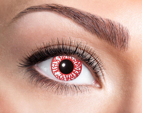 Efektipiilolinssit verestävä silmä 7 pv